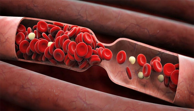 6 природных средств, которые разжижают кровь и выполняют профилактику сгустков крови