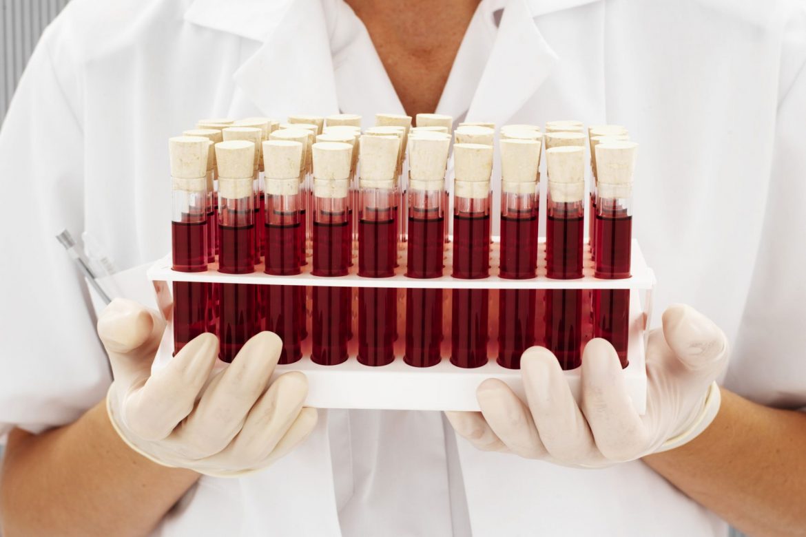 7 фактов, которые стоит знать о своей группе крови