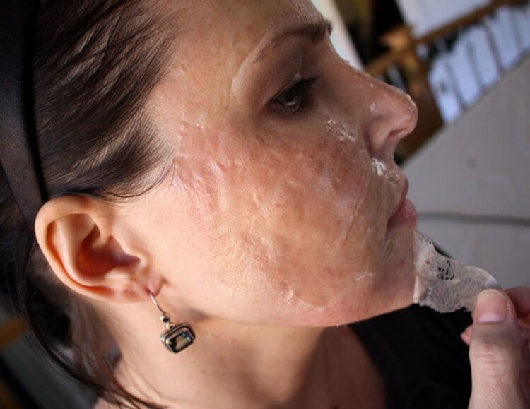 Как избавиться от морщин, очистить поры и улучшить тонус кожи в домашних условиях