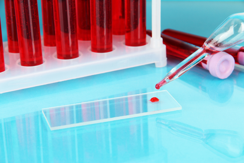 Расшифровка общего анализа крови: удобная таблица с пояснениями и краткий обзор основных показателей