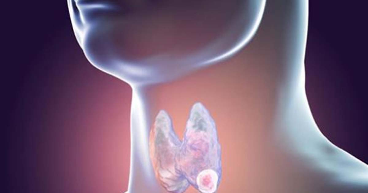 Почему щитовидка — орган недовольства