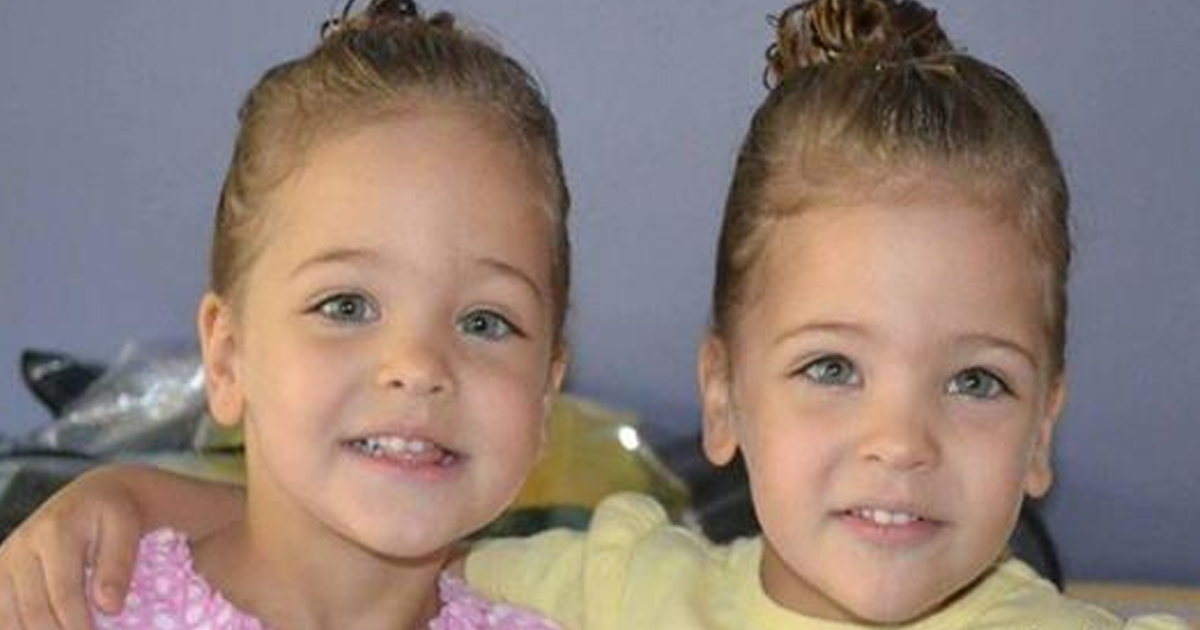 История близнецов, которых признали самыми красивыми близнецами в мире