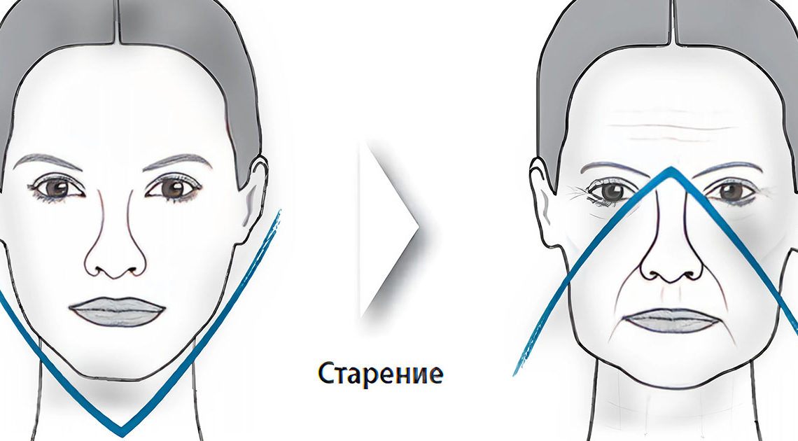 Как избавиться от обвисших щек? Если хотите иметь идеальную форму лица, вам обязательно нужно сделать это!