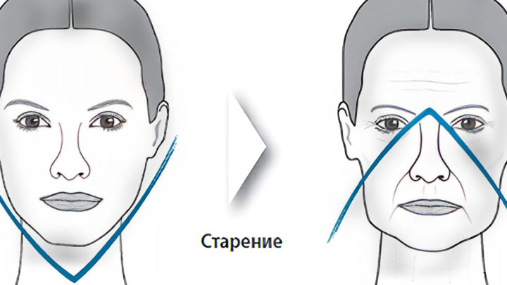 Как избавиться от обвисших щек? Если хотите иметь идеальную форму лица, вам обязательно нужно сделать это!